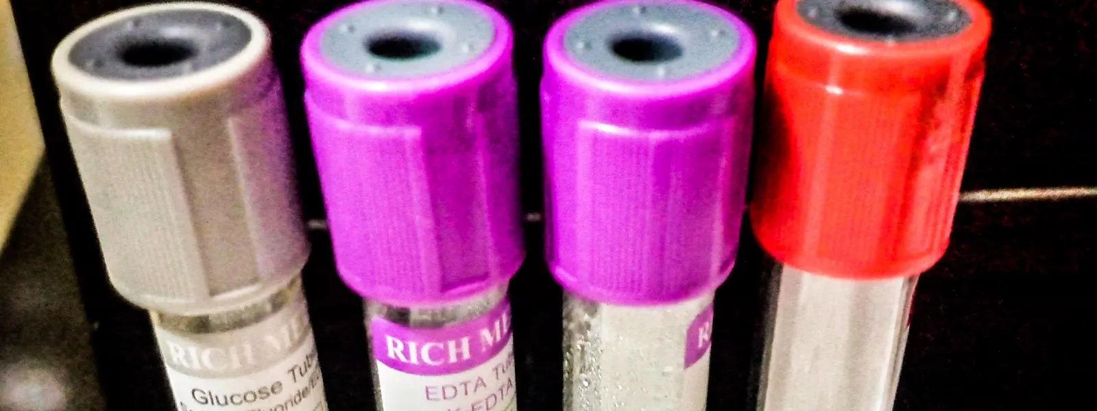 Laboratorio de Pinky